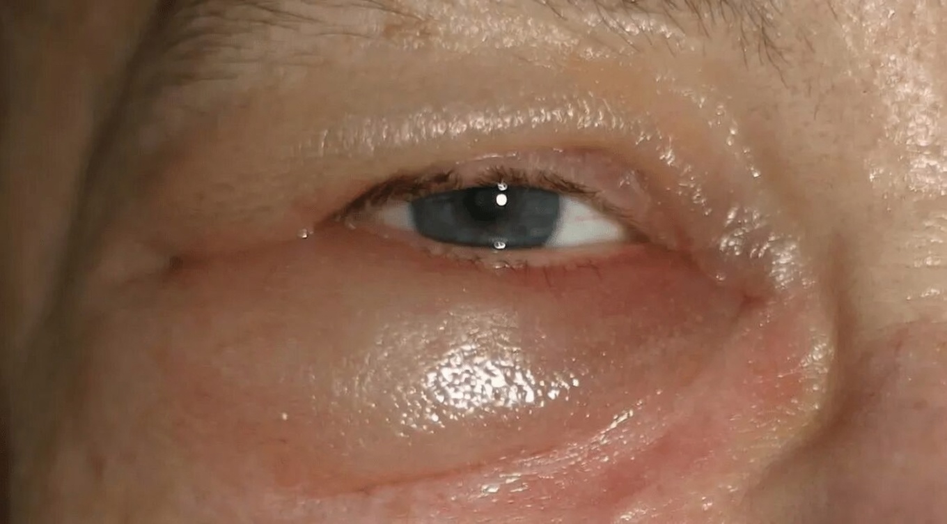 23 Signes d’alerte importants indiquant que vos reins pourraient souffrir en silence et nécessitent une attention