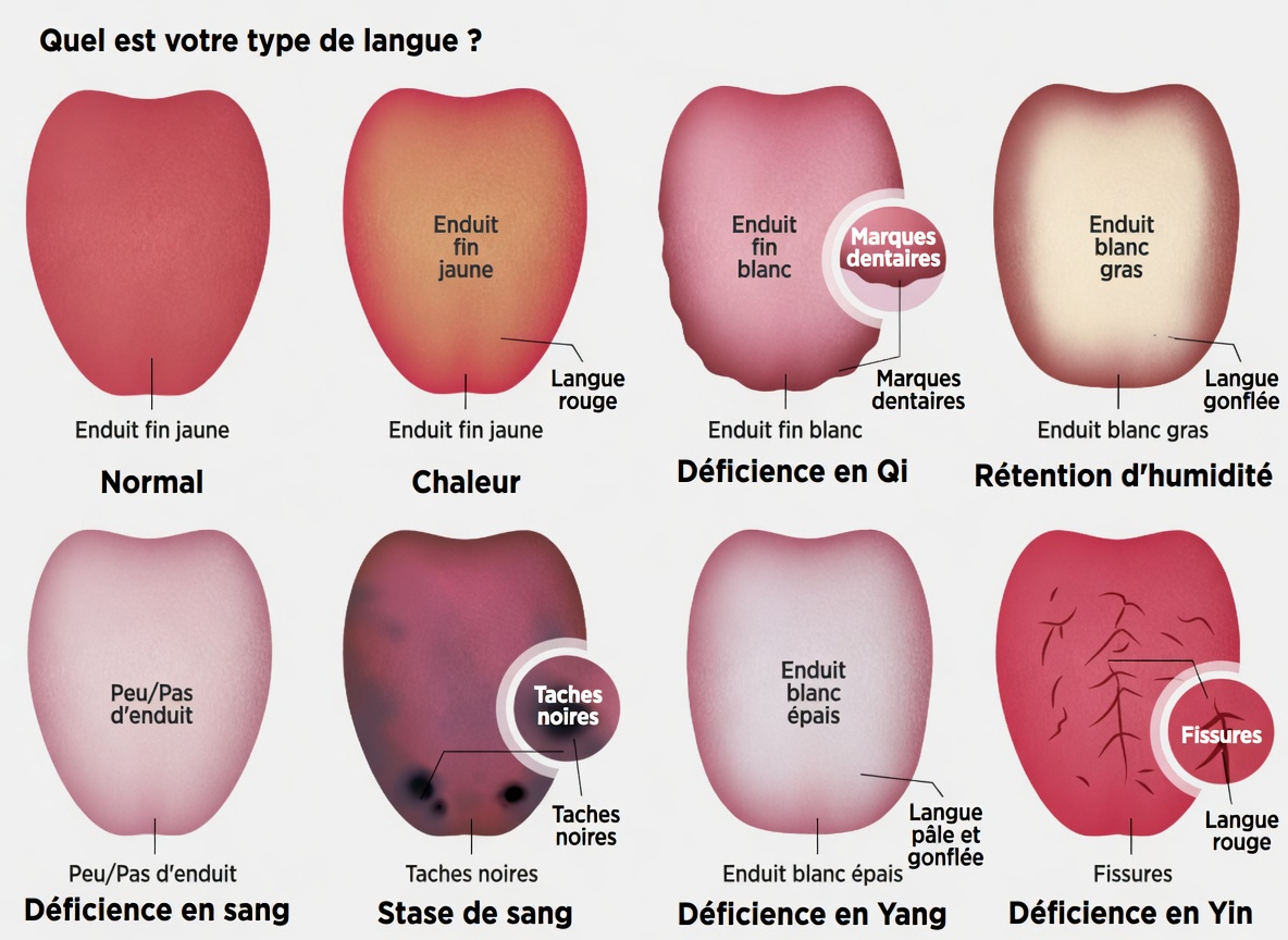Que révèle la couleur de votre langue sur vos habitudes de santé