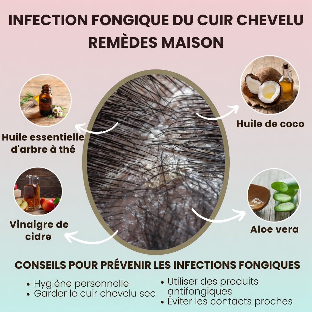 Anneaux rouges sur le cuir chevelu de votre enfant avec des cheveux qui se cassent ? Conseils essentiels pour les parents