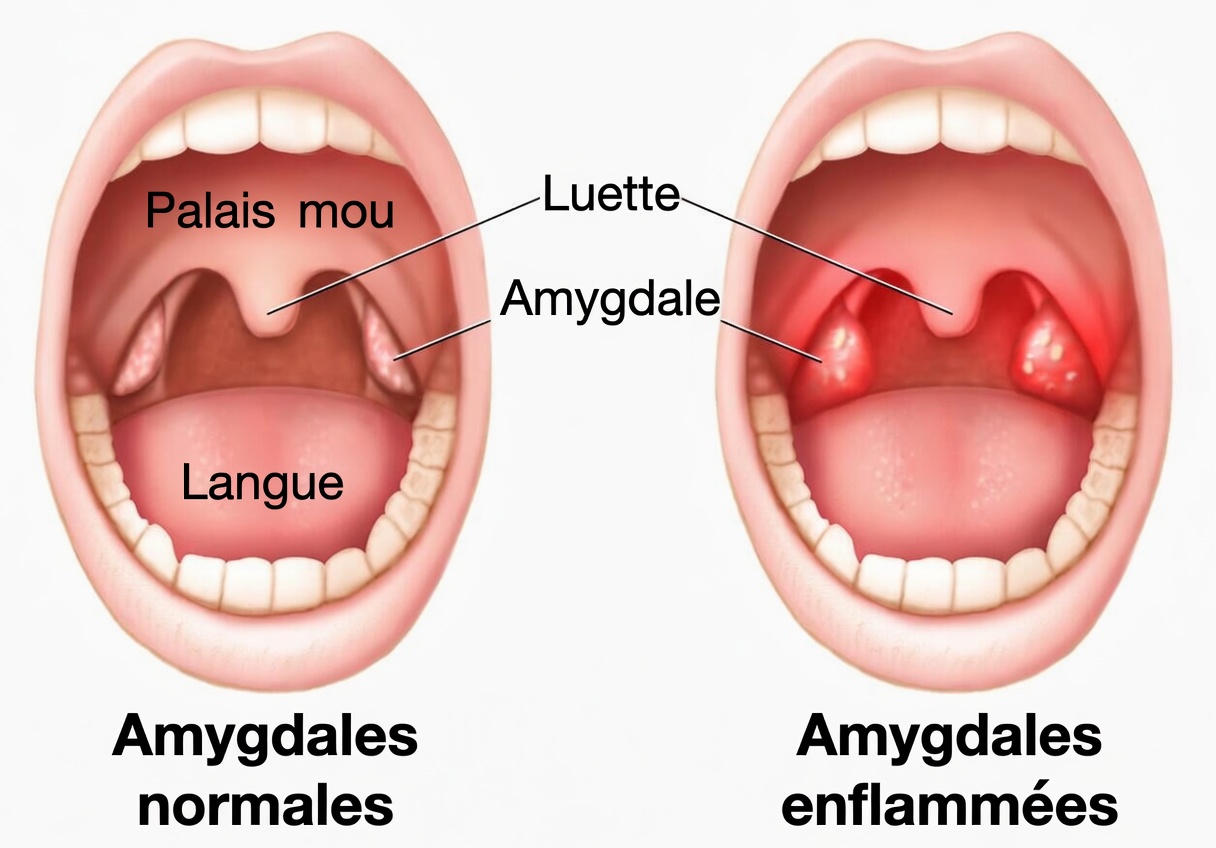 8 affections associées à la bave pendant le sommeil que vous devriez faire examiner