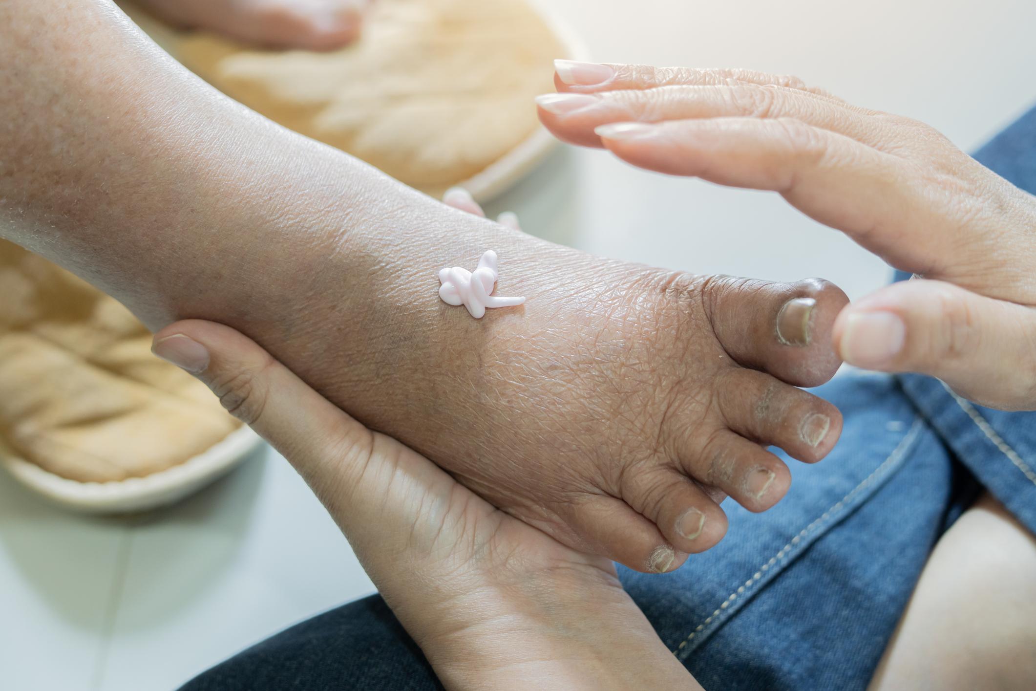 Seniors : vos pieds souffrent-ils en silence ? Essayez cette routine au vinaigre de cidre de pomme