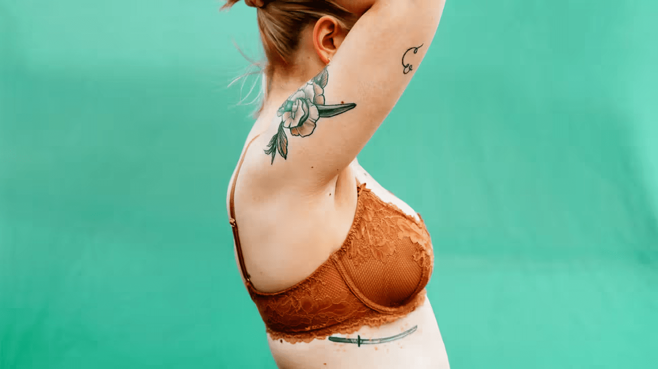 Que faire en cas d’éruption cutanée prurigineuse sous les seins cet hiver lorsque votre médecin n’est pas disponible