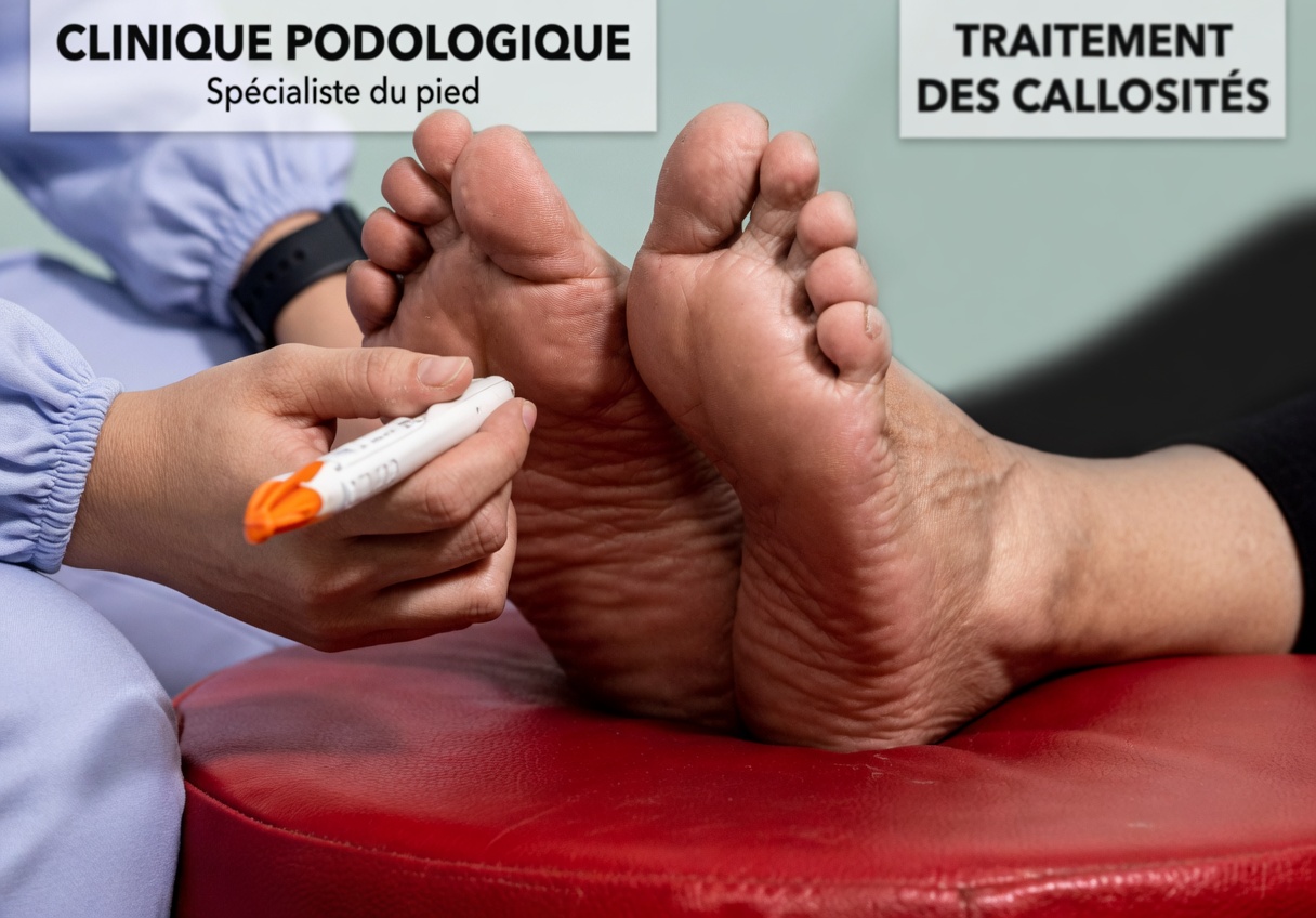 Éliminez l’engourdissement des jambes, le diabète, les démangeaisons, les crampes et l’hypertension artérielle avec une seule tasse de ce mélange