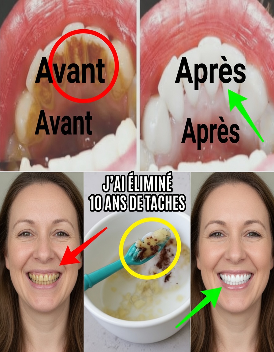 Blanchissez vos dents en 2 minutes : le secret de la peau de banane qui choque tout le monde