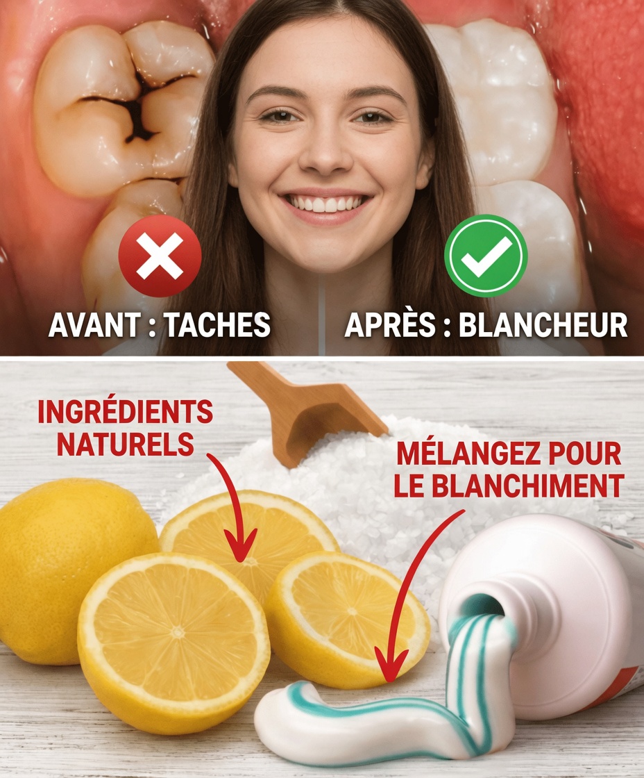 Comment réparer naturellement une carie et renforcer vos dents