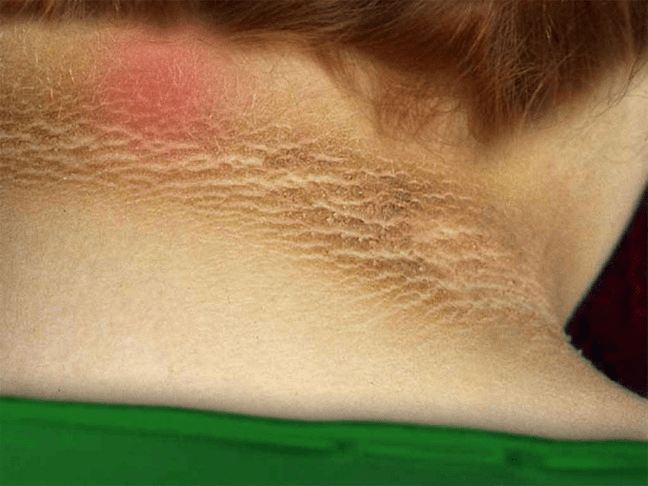 15 signes précoces d’alerte du diabète que vous devriez reconnaître pour une meilleure sensibilisation à la santé