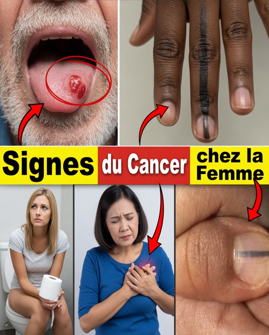 Négligez-vous ces 14 signes d’alerte importants du cancer chez les femmes ?