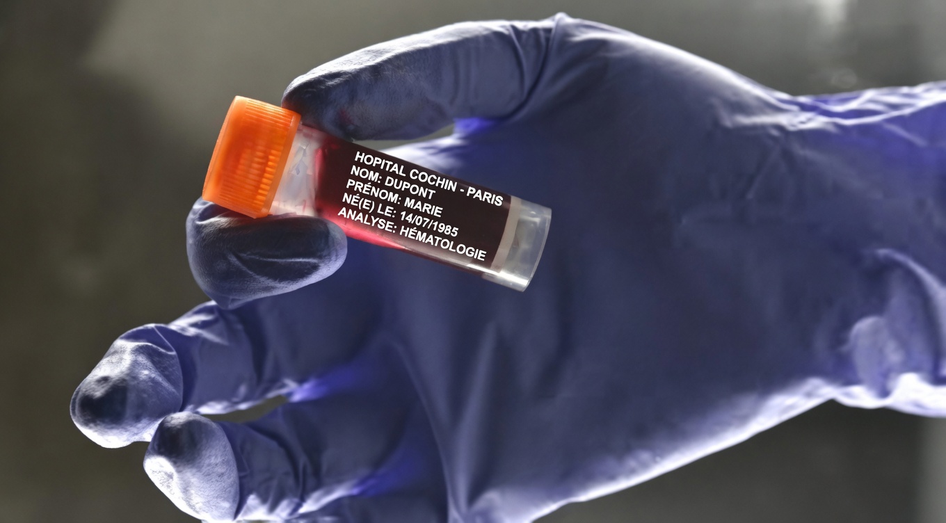 Les médecins révèlent : le groupe sanguin O semble lié au risque global de cancer le plus faible dans plusieurs études