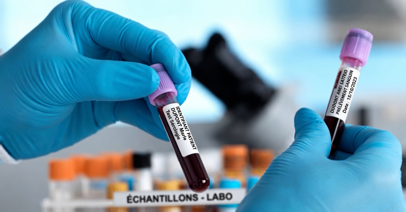 Les médecins révèlent : le groupe sanguin O semble lié au risque global de cancer le plus faible dans plusieurs études