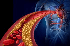 Les médecins révèlent : le groupe sanguin O semble lié au risque global de cancer le plus faible dans plusieurs études