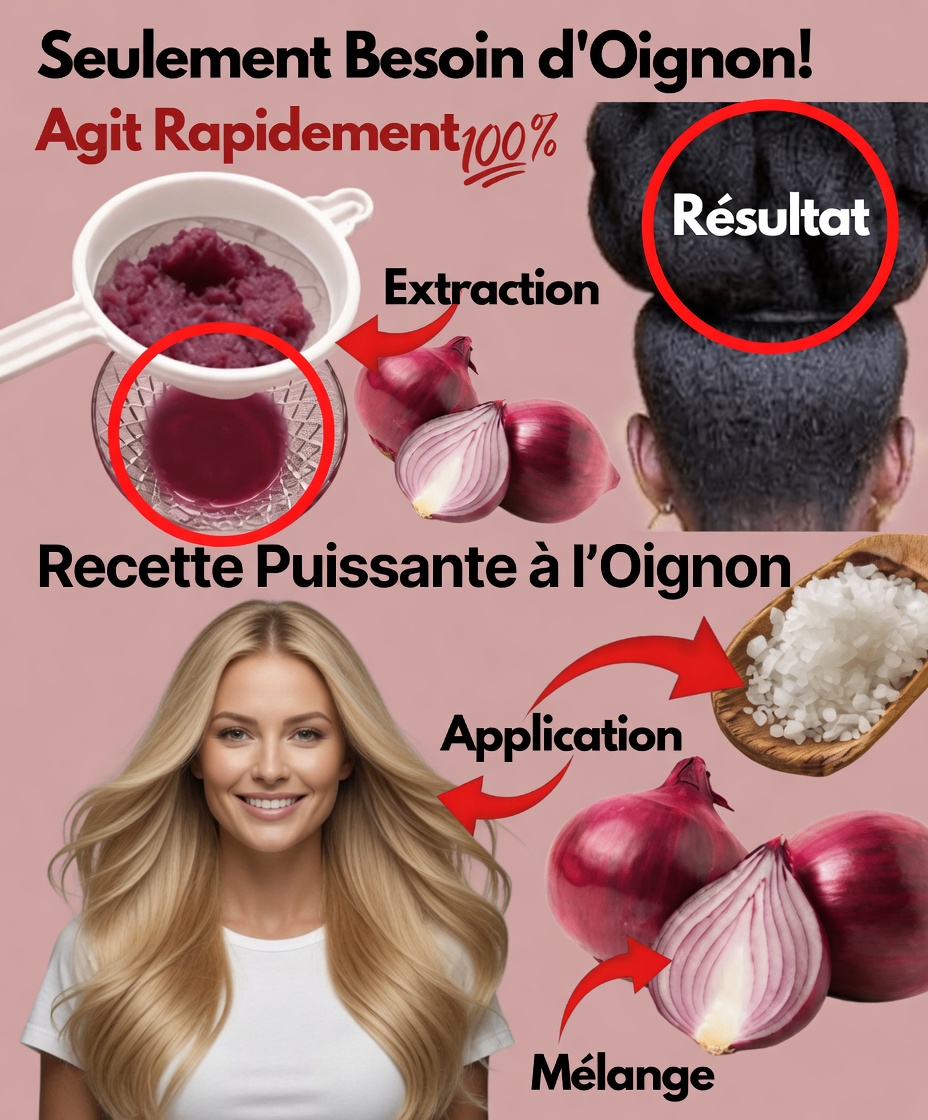 Jus d’oignon pour la pousse des cheveux : ce que seulement 7 jours peuvent faire pour votre cuir chevelu