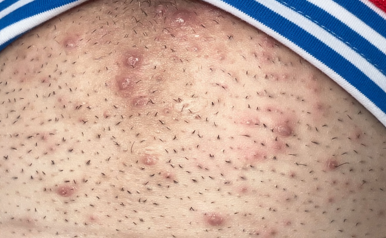 Arrêtez de vous raser : exploration de l’astuce populaire d’épilation à l’oignon et au dentifrice