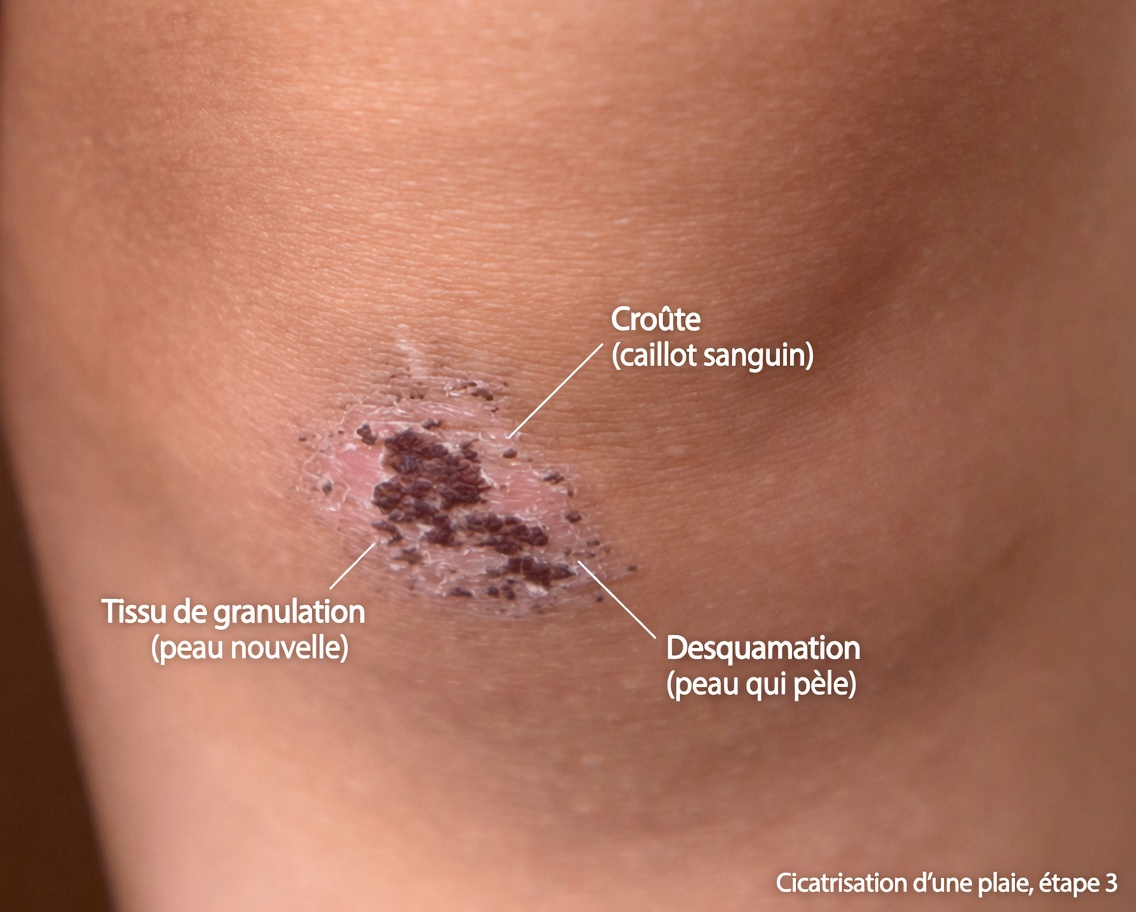 Votre corps vous supplie-t-il d’avoir plus de vitamine D ? Découvrez ces 8 signes étranges