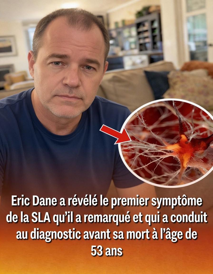 Premier symptôme de la SLA chez Eric Dane : ce que sa faiblesse précoce de la main peut nous apprendre sur les changements neurologiques subtils