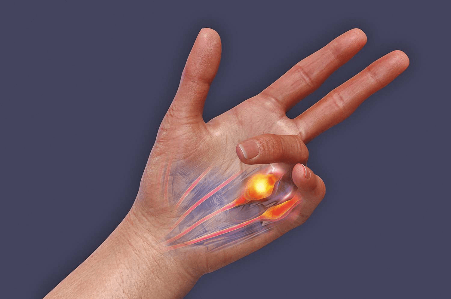 Premier symptôme de la SLA chez Eric Dane : ce que sa faiblesse précoce de la main peut nous apprendre sur les changements neurologiques subtils