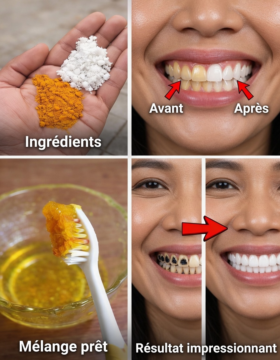 Curcuma pour blanchir les dents : cette épice naturelle illumine-t-elle vraiment votre sourire ?