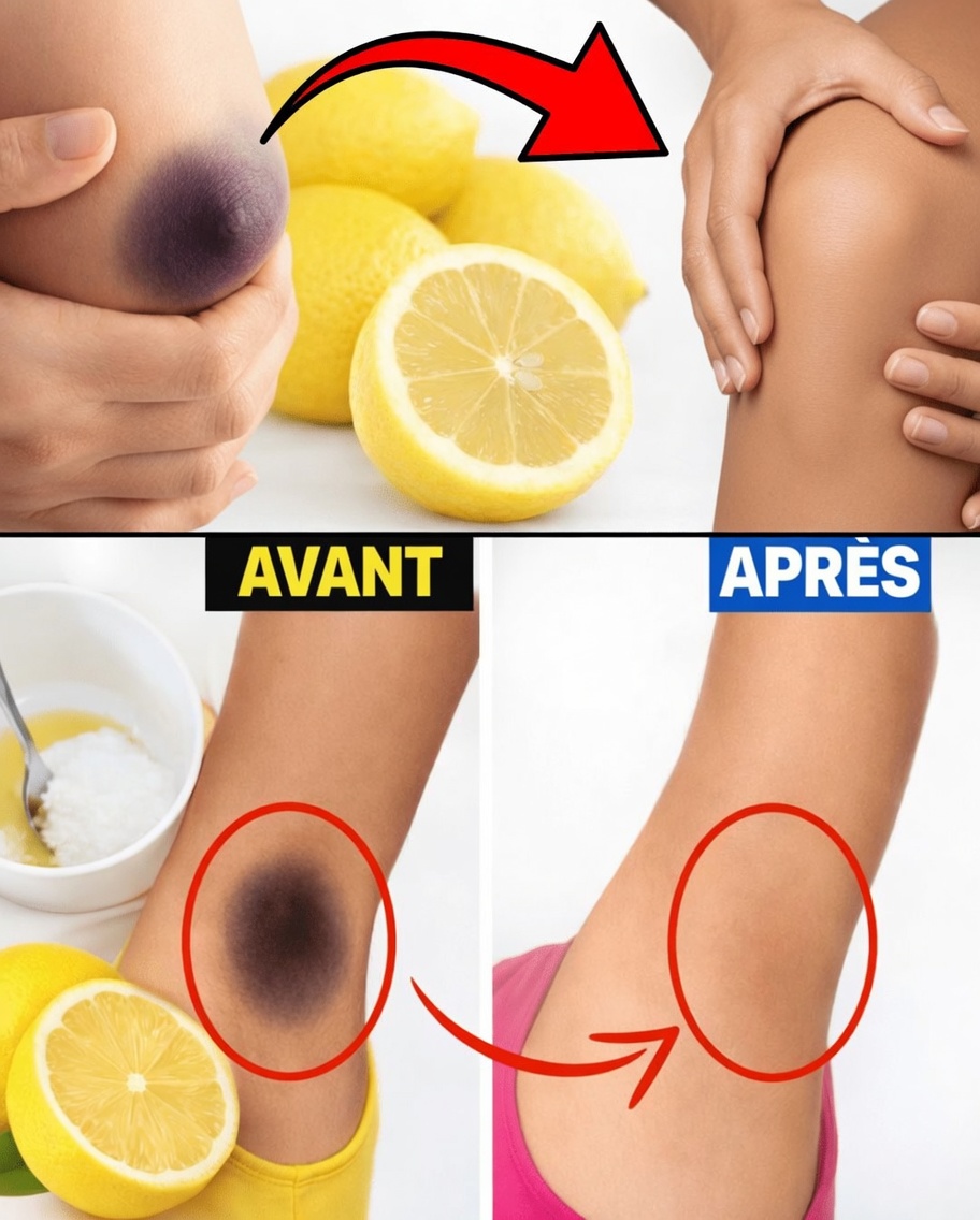 Aisselles sombres ? Découvrez des remèdes maison sûrs et de vraies solutions pour les éclaircir naturellement