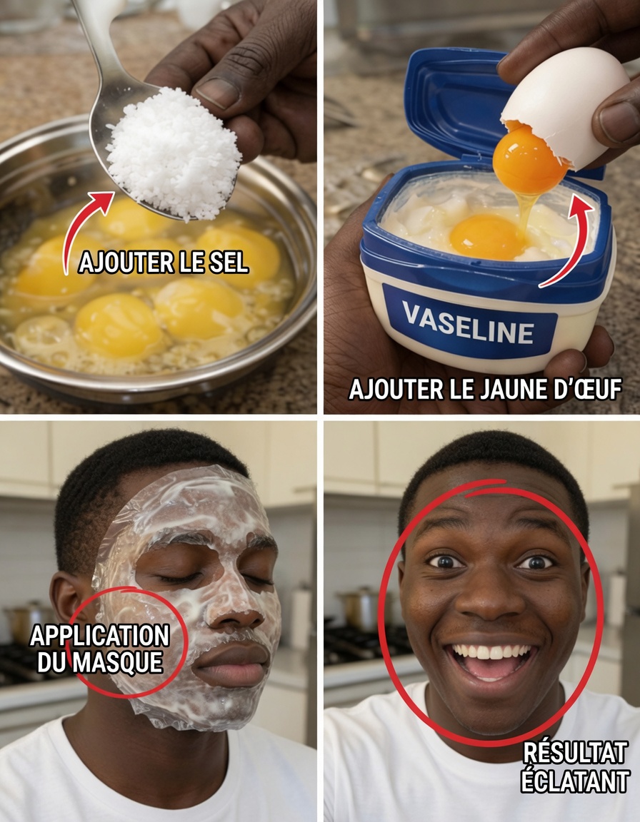 Plus de rides à 65 ans ! Le masque de nuit au jaune d’œuf et à la vaseline qui a tellement repulpé le visage de ma mère que ses amies ont cru qu’elle avait eu des injections de comblement