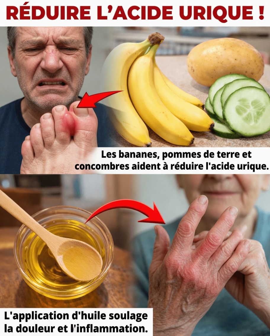 Top 8 des aliments pouvant contribuer à soutenir naturellement des niveaux sains d’acide urique