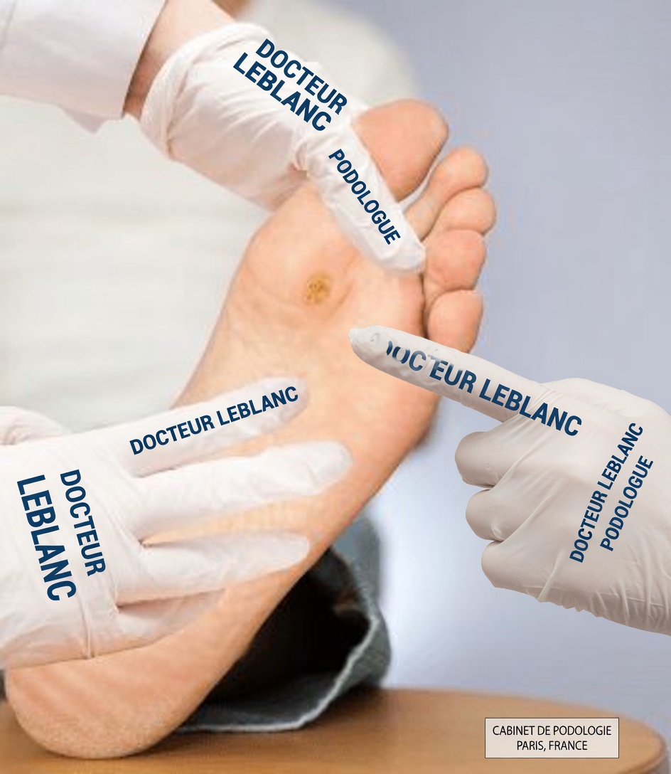 Le peroxyde d’hydrogène peut-il aider à traiter les verrues ? Utilisations pratiques, conseils de sécurité et à quoi s’attendre à la maison