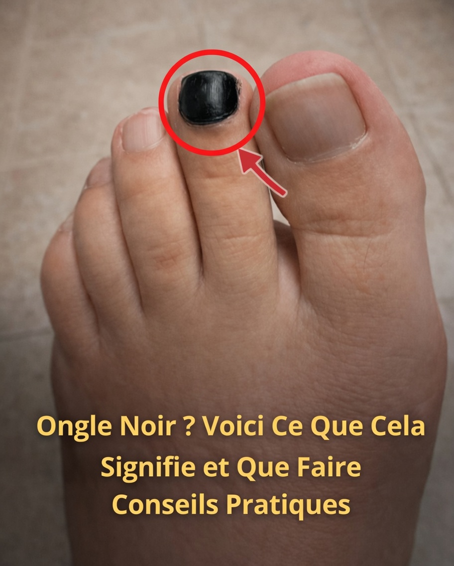 Ce que votre ongle d’orteil noir pourrait vous dire : causes courantes et habitudes quotidiennes judicieuses à envisager