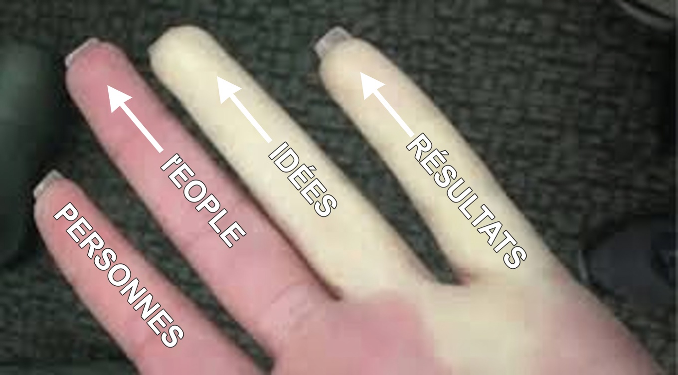 7 signes d’alerte souvent négligés d’un AVC lacunaire chez les personnes de plus de 60 ans (vous passez peut-être à côté du n°4)