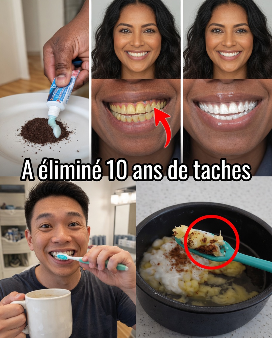 Pourquoi la décoloration des dents se produit et pourquoi elle dérange tant de gens