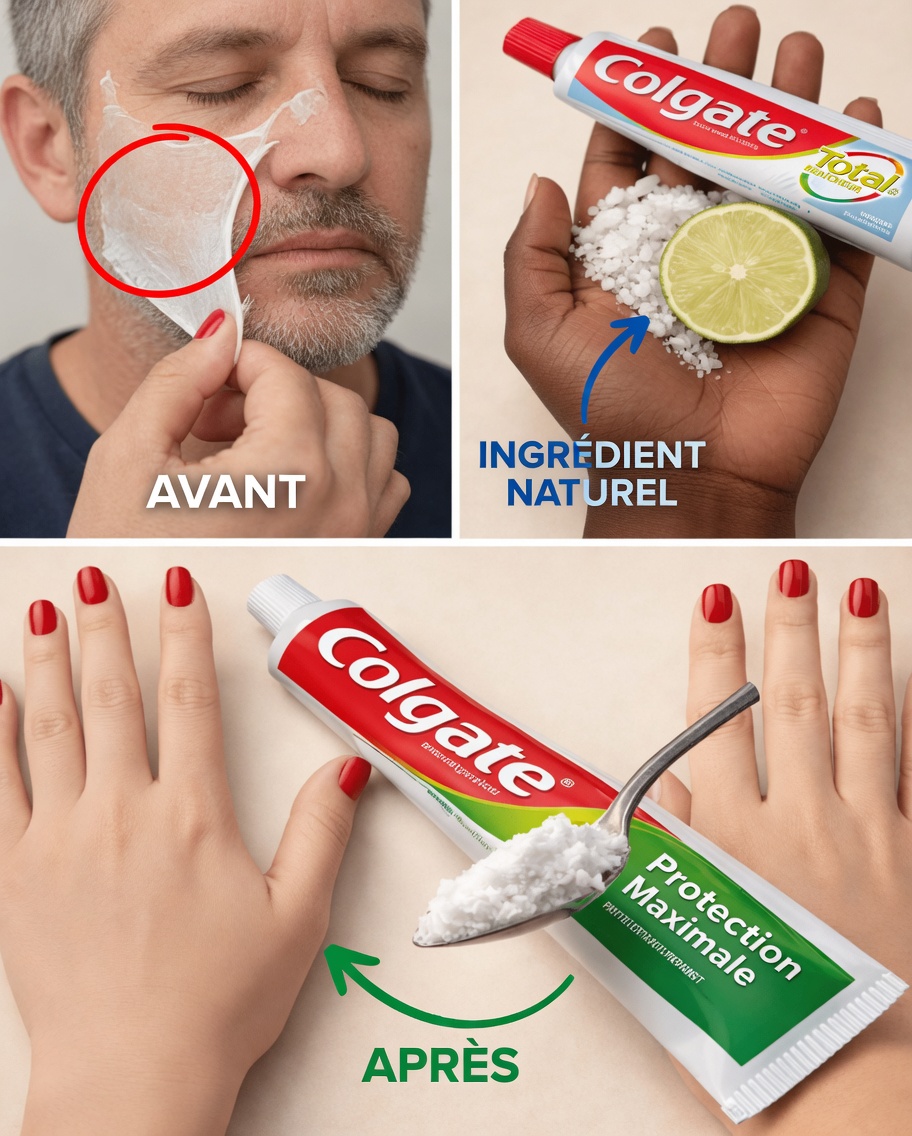 Pourquoi le dentifrice et le bicarbonate de soude ne sont pas un choix judicieux pour traiter les rides et les taches brunes — et des options plus douces à envisager à la place