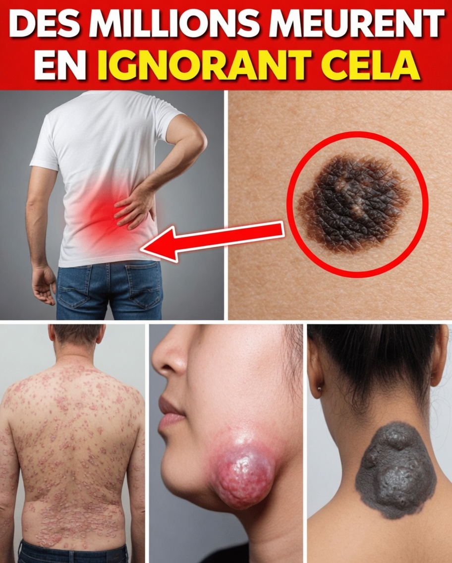 10 signes subtils du cancer colorectal que vous êtes probablement en train d’ignorer (les médecins manquent souvent le n°3 chez les jeunes adultes)