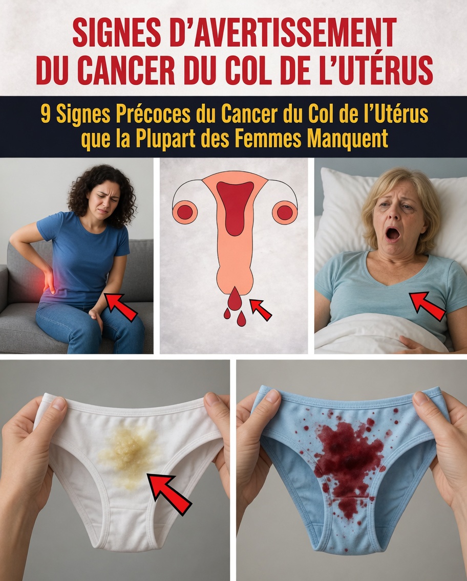 9 signes avant-coureurs précoces du cancer du col de l’utérus à ne jamais ignorer