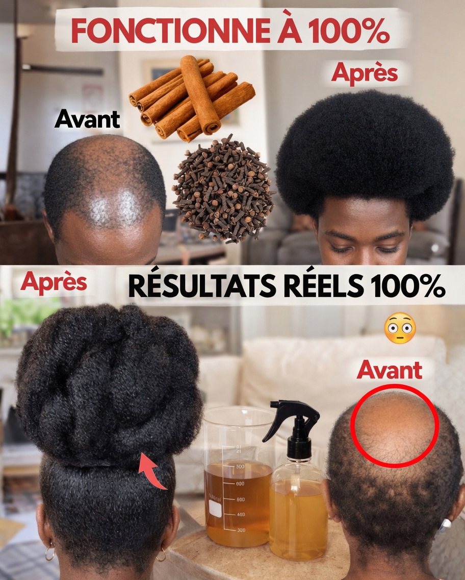 Clous de girofle et cannelle : explorer leur rôle potentiel pour des cheveux plus sains et plus volumineux