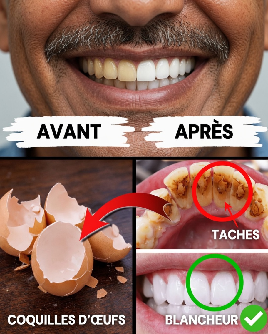 Les coquilles d’œufs peuvent-elles aider à obtenir des dents plus blanches et d’apparence plus saine ? Une approche naturelle à explorer